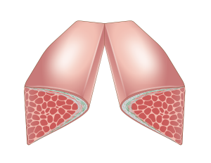 Open Vocal Cords