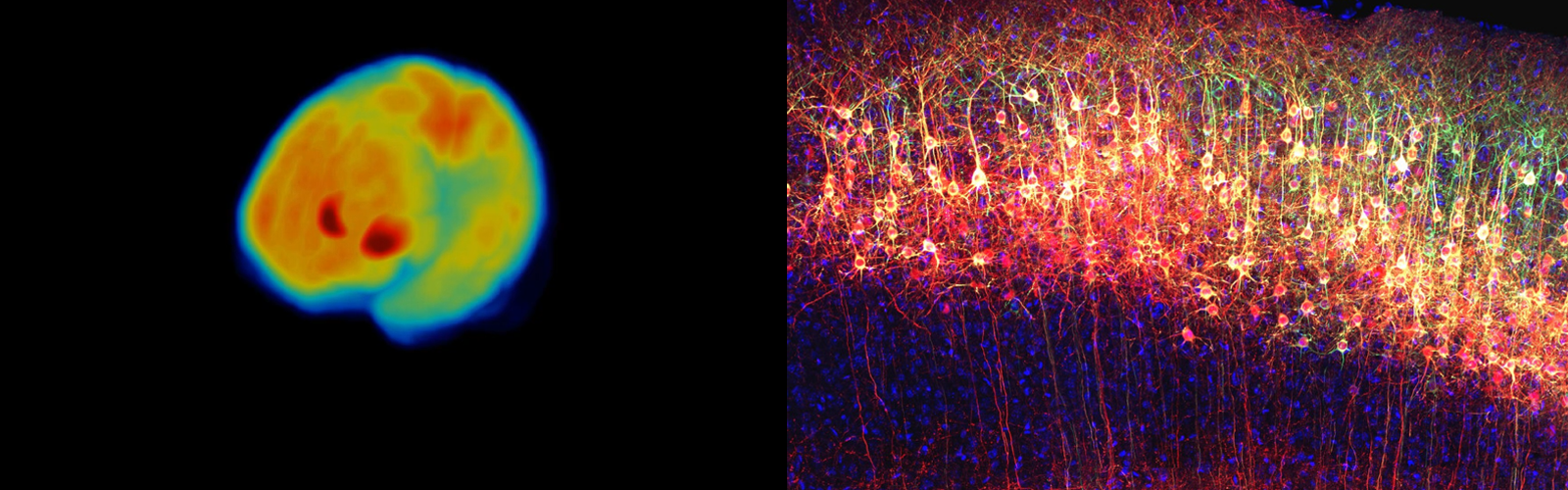 UW-Madison’s Cool Science Image Contest: Waisman Winners