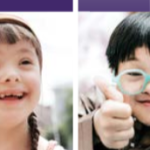 Down syndrome medication study
