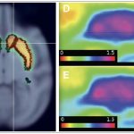 Brain imaging slides