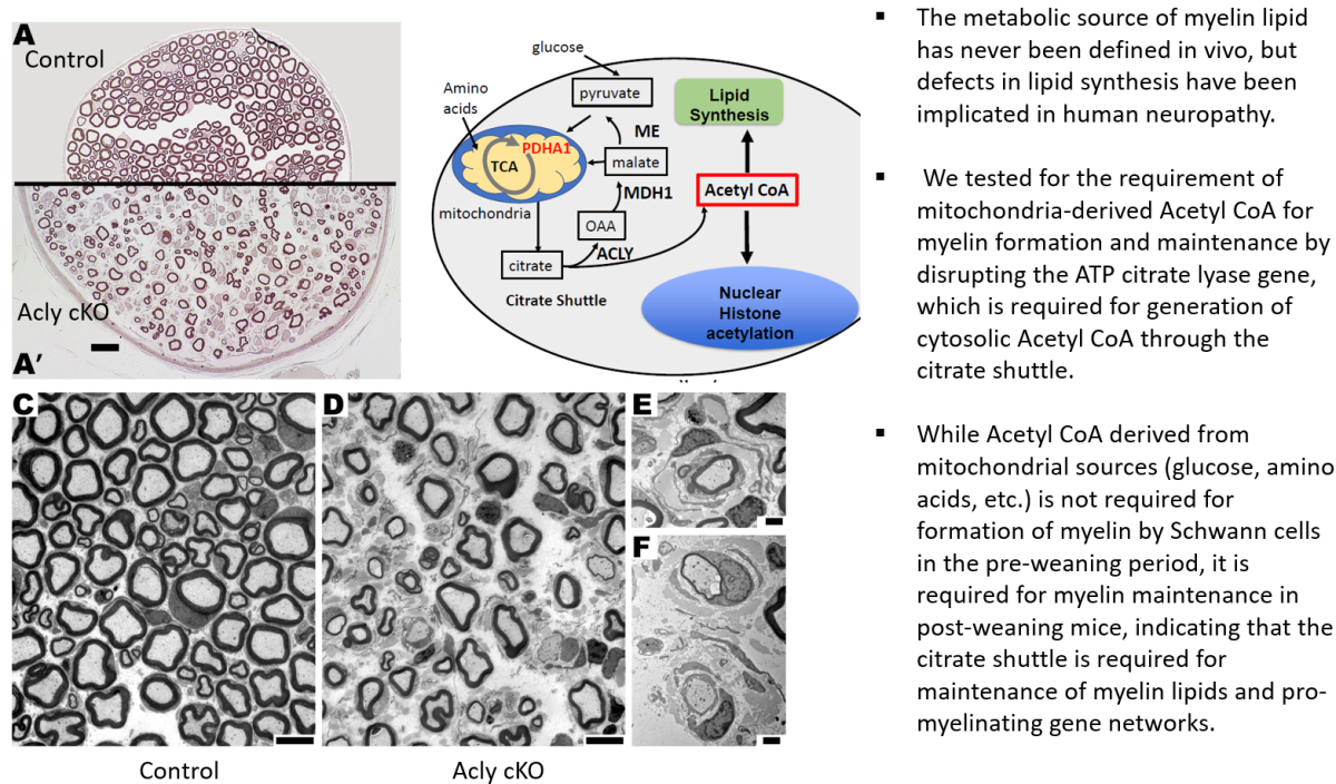 John Svaren, PhD - Slide of the Week