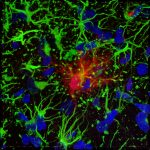 Astrocytes