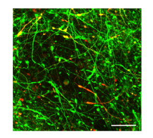 Color coded neurons.
