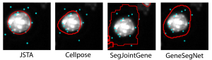 examples of cell segmentation results using four different software