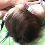 Newborn hearing screening